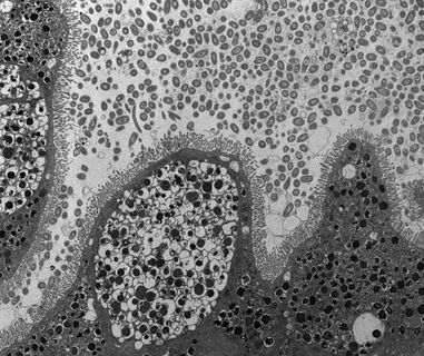 Bioscience Electron Microscopy Laboratory Background