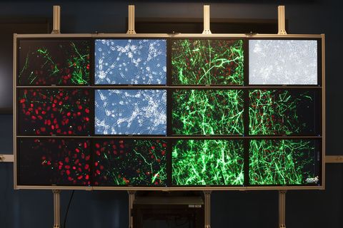 Sanger Sequencing and Fragment Analysis