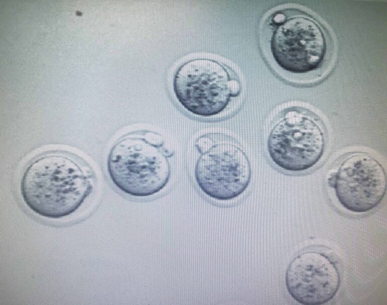 IVF Cell Diagram