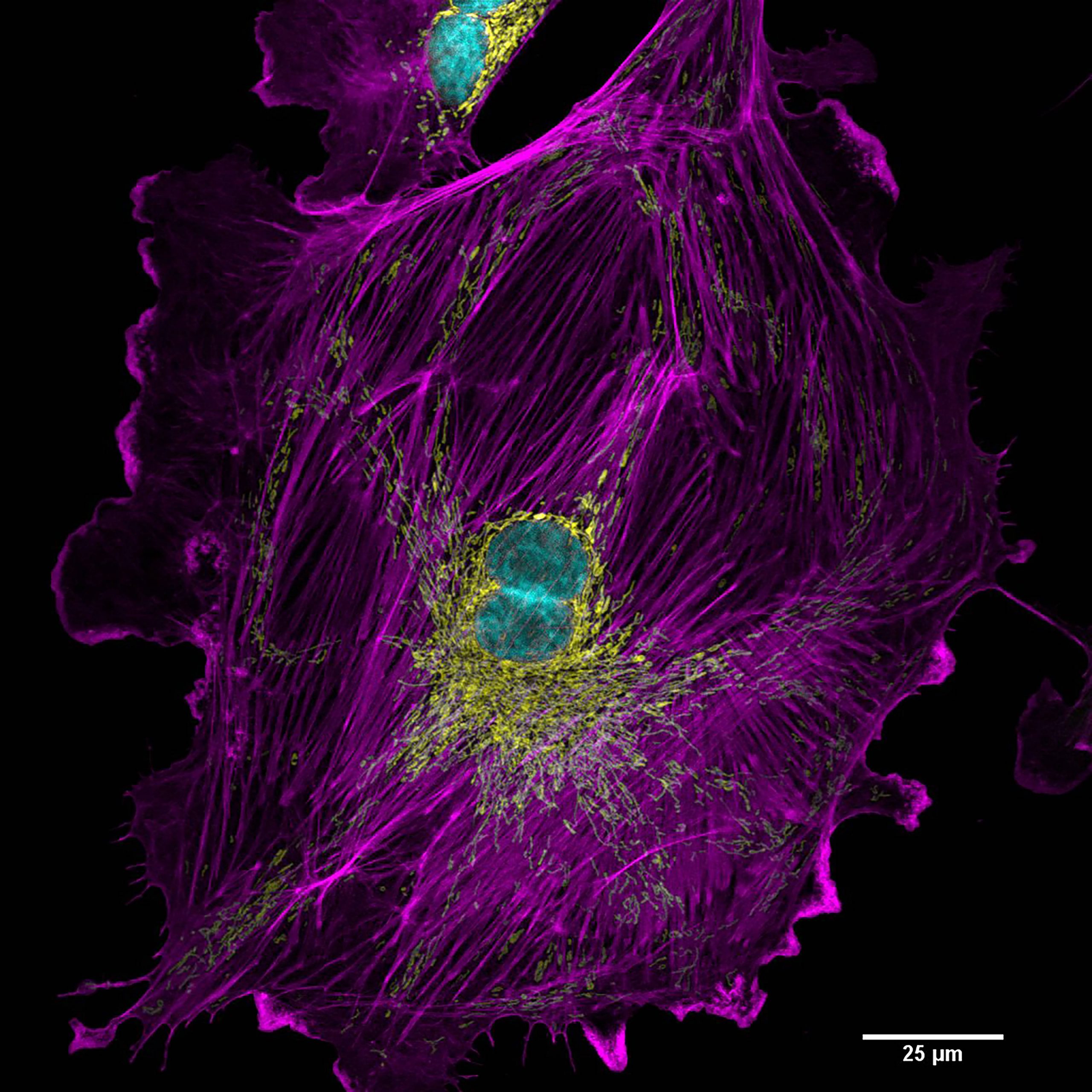 bpae cell scan
