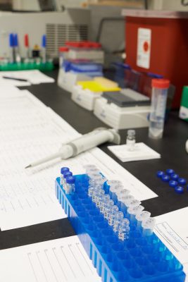 sample prep